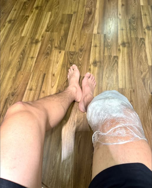 Tình trạng nghiêm trọng của nam thần VFC sau 1 năm bị đứt dây chằng chéo trước- Ảnh 1.