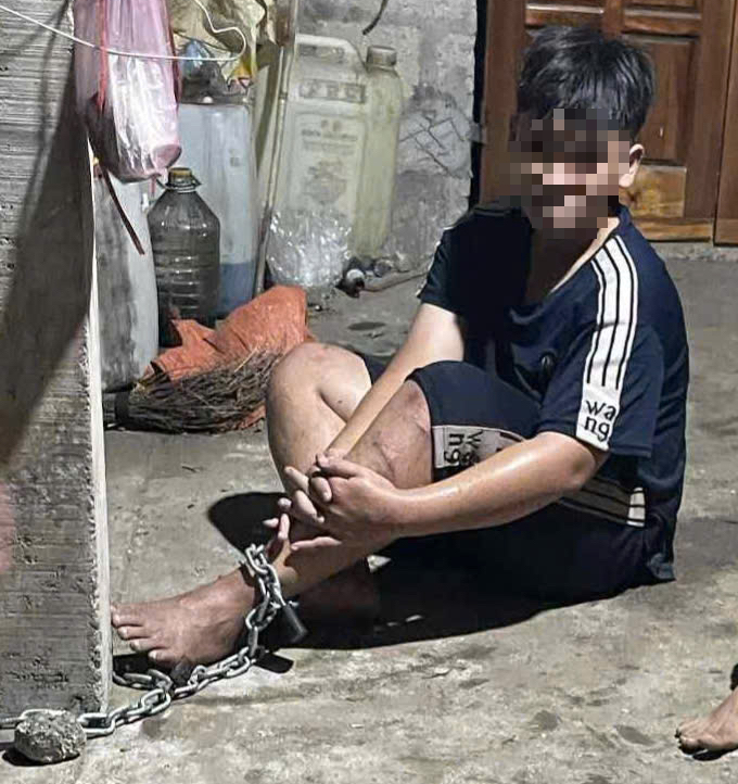 Điều tra vụ cháu bé nghi bị xích chân, đánh đập bằng roi sắt vì ném đá lên mái tôn - Ảnh 1.