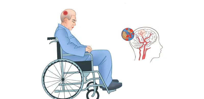 Sau 9h tối, tốt nhất đừng làm 3 việc này: Cơ thể sẽ cảm ơn bạn vì được ngủ ngon lại tránh đột quỵ- Ảnh 1.
