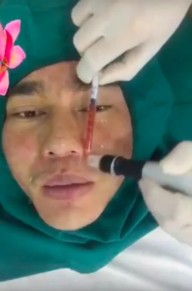 Sao nam Việt nghiện phẫu thuật thẩm mỹ: Từng cứ 10 ngày lại đi chỉnh sửa 1 lần, bị tụt sụn mũi khi đang chạy bộ- Ảnh 4.