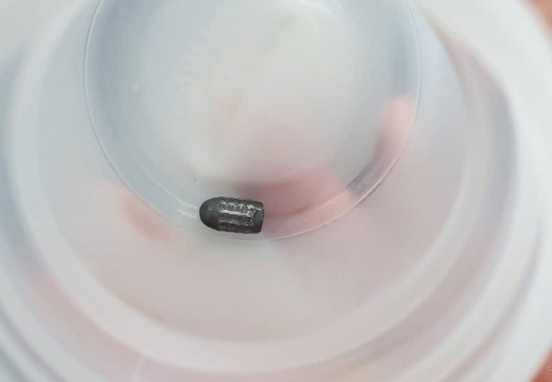 Xác định được đối tượng dùng súng bắn chim khiến đạn lạc trúng đầu người phụ nữ làm vườn -0