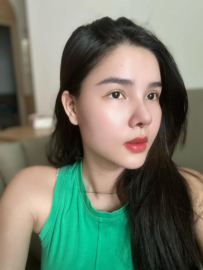 Người mẫu Việt tự khui ảnh thẩm mỹ mặt, thừa nhận rơi khủng hoảng vì sợ biến dạng vĩnh viễn- Ảnh 8.