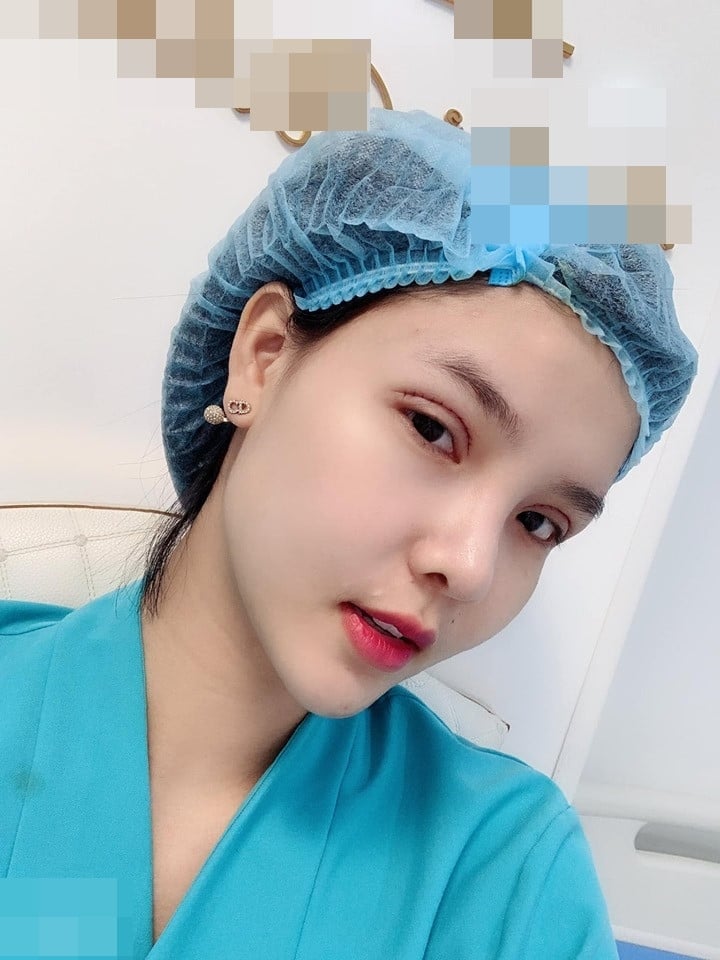 Người mẫu Việt tự khui ảnh thẩm mỹ mặt, thừa nhận rơi khủng hoảng vì sợ biến dạng vĩnh viễn- Ảnh 7.