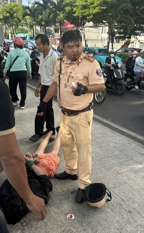 Trung tá Cảnh sát giao thông bị thanh niên Nga tấn công ở Nha Trang - Ảnh 1.