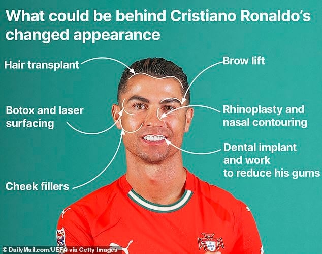 Ronaldo 40 tuổi vẫn đẹp trai cực phẩm, bác sĩ thẩm mỹ khui loạt bí mật 