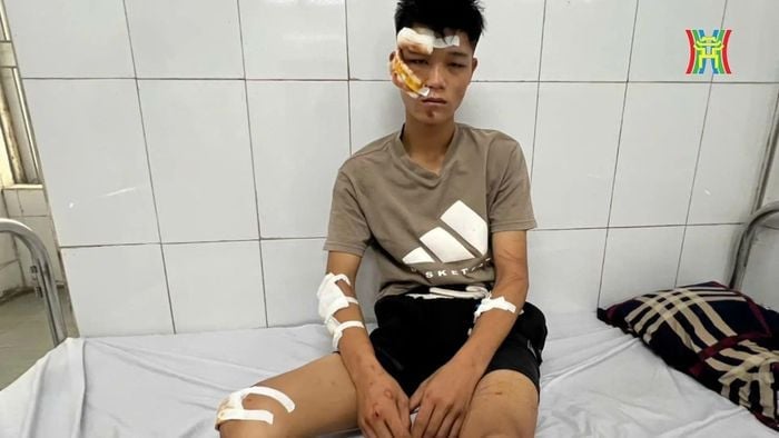 Lời khai của đối tượng 'thông chốt' đường cấm, tông thẳng vào cảnh sát cơ động- Ảnh 1.