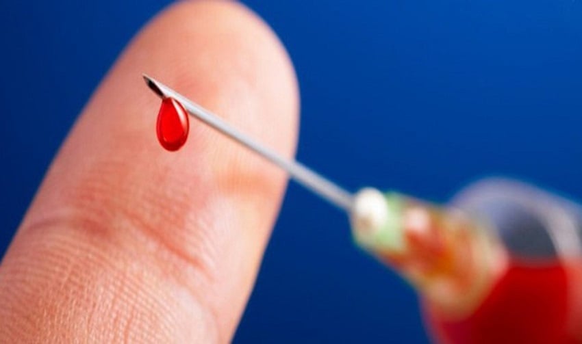Lan truyền video dùng giấy vệ sinh công cộng nhiễm HIV khiến nhiều người lo lắng nguy cơ lây bệnh: Thực hư thế nào?- Ảnh 4.