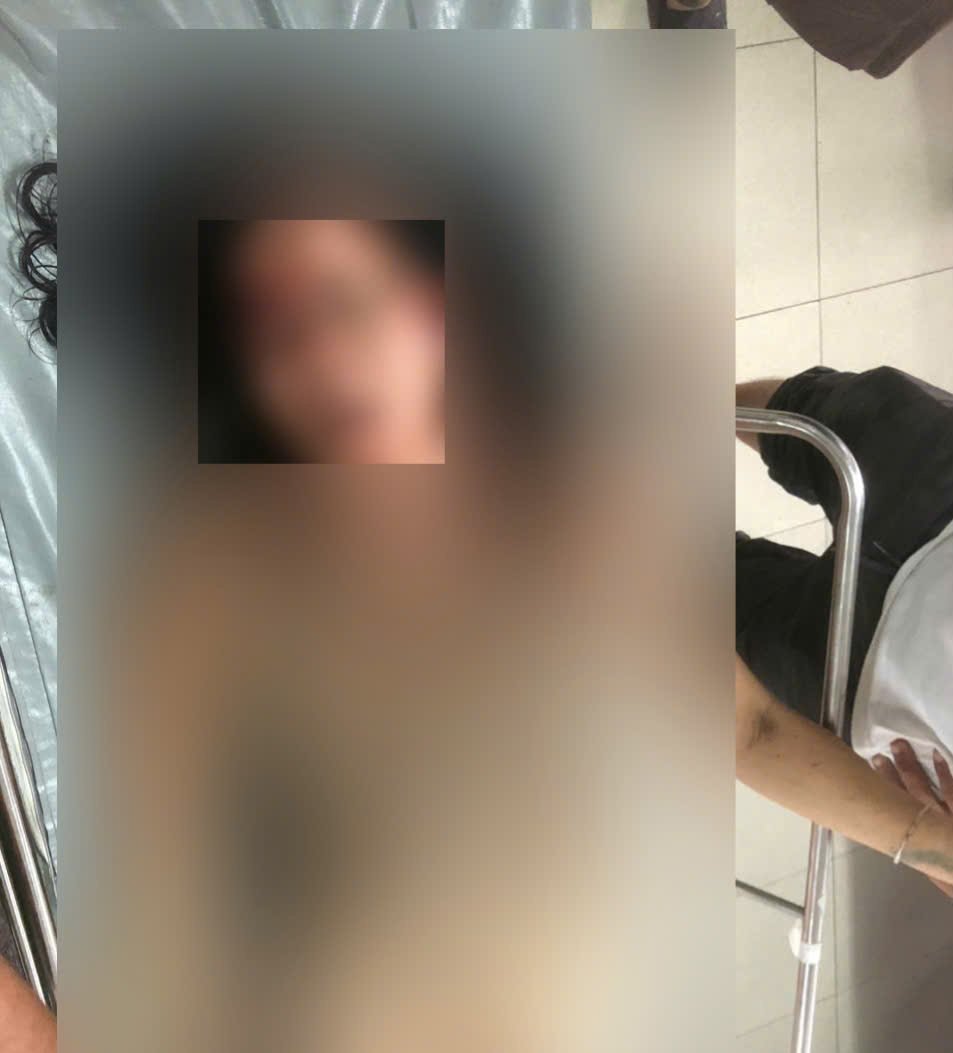 Tây Ninh: Mẹ và con gái bị bắn trọng thương, nghi phạm đã tự sát- Ảnh 1.