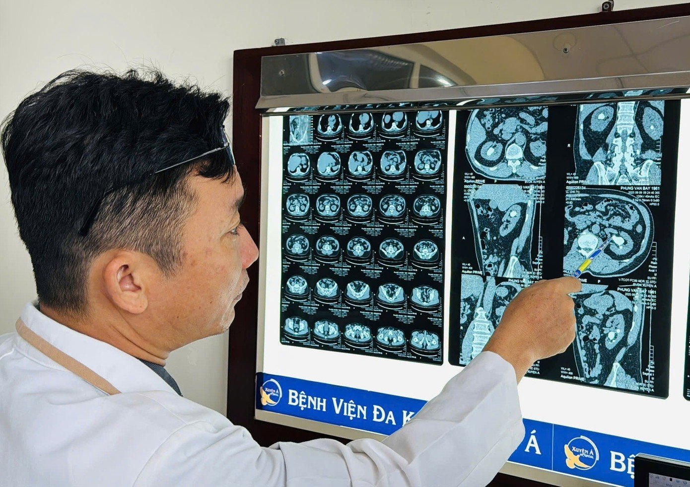 bac-si-doc-phim-xac-dinh-vi-tri-vien-soi.jpg