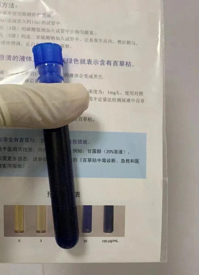 Người đàn ông có nước tiểu 