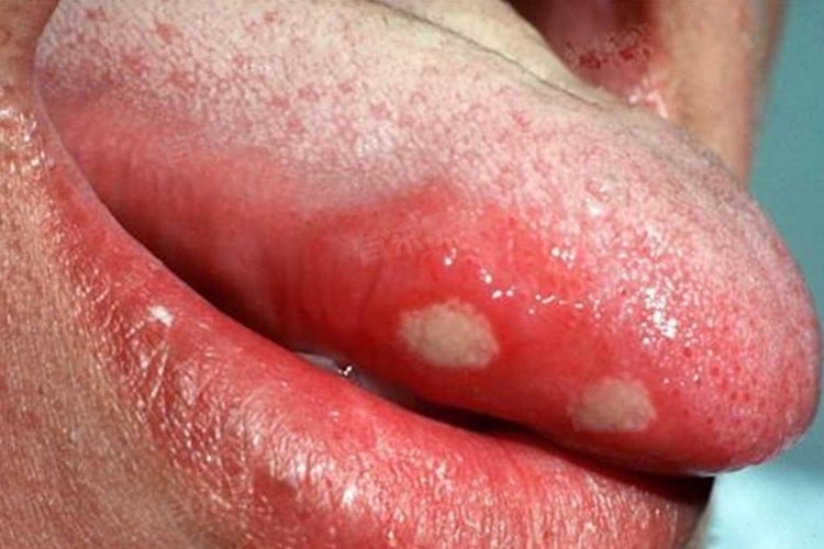 Bạn có thể đã trở thành 