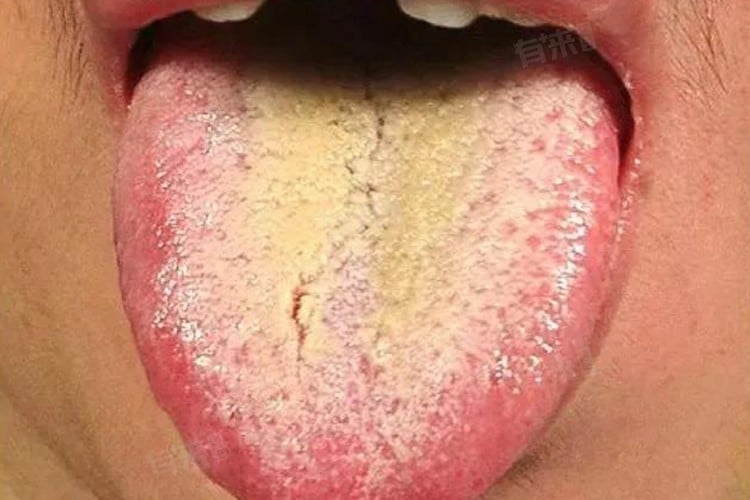 Bạn có thể đã trở thành 
