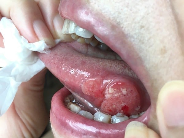 Bạn có thể đã trở thành 