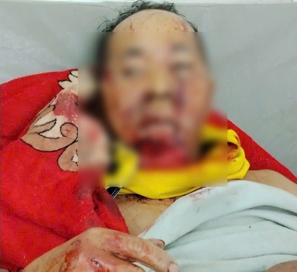 Trưởng thôn Đà Nẵng bị gấu rừng tấn công khiến nhiều người lo lắng - Ảnh 1.