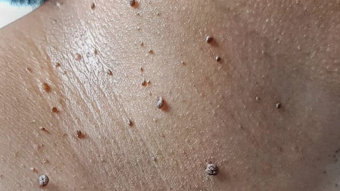 Người có 4 thứ này trên da dễ có