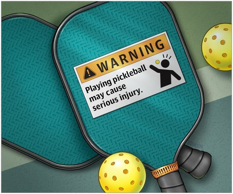 Đánh pickleball trúng mắt khiến nhiều người mất thị lực tạm thời- Ảnh 1.