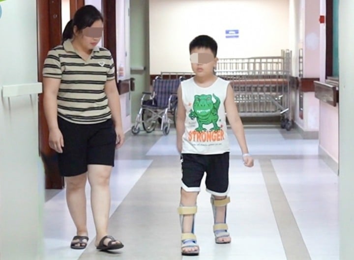 Bé trai bại não có thể tự bước đi sau ca phẫu thuật chưa từng có ở Việt Nam.