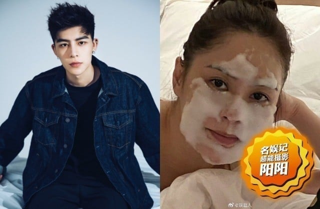 Ngoại hình phát tướng gây sốc của Chung Hân Đồng, đột ngột tăng đến 75 kg là vì sao?- Ảnh 6.