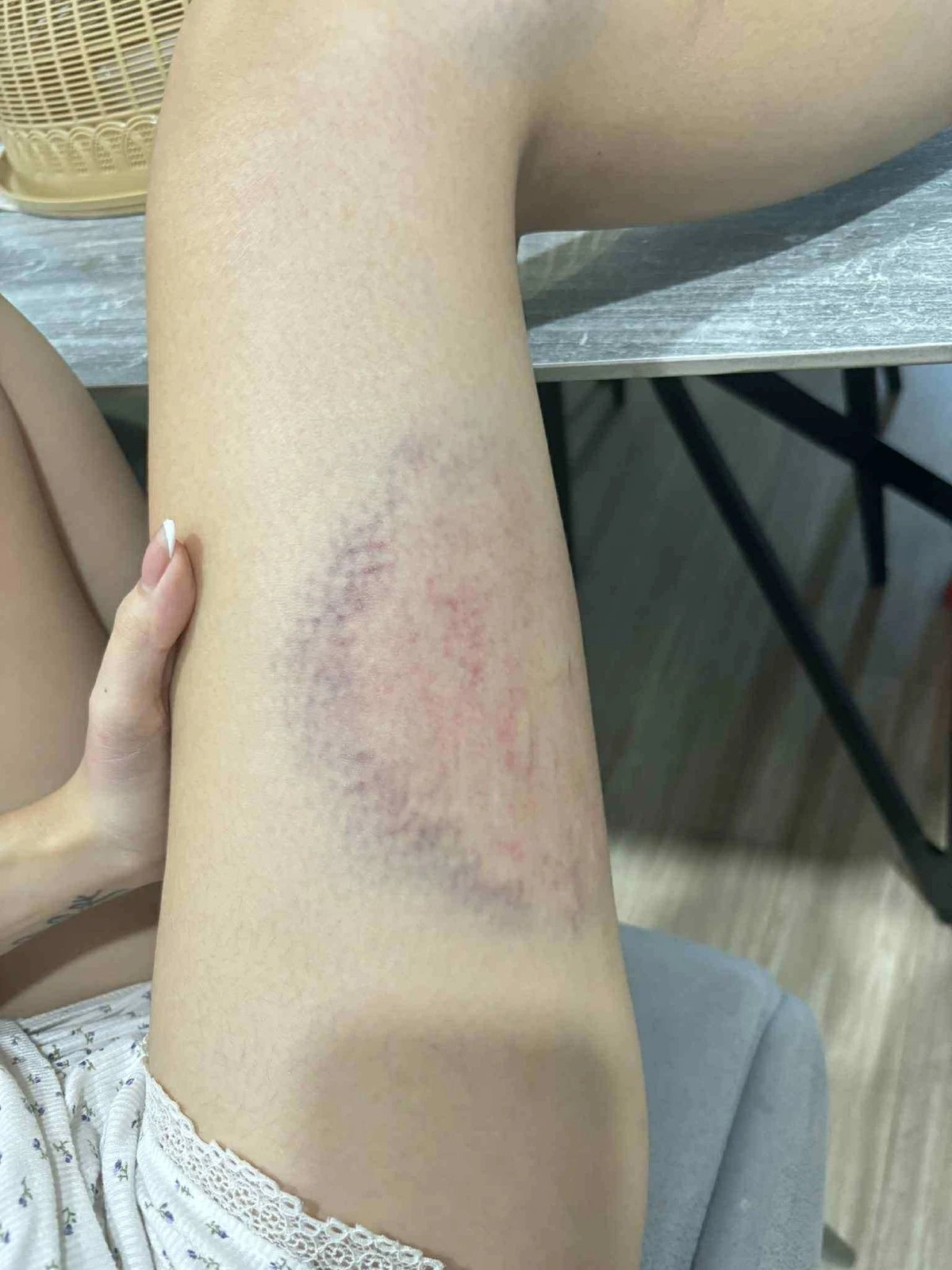 danh vo o chung cu anh 3