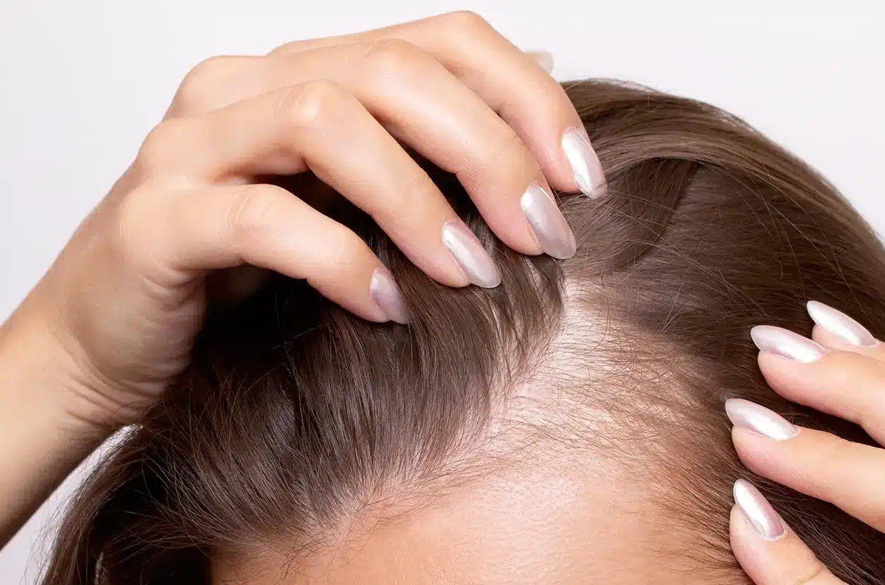 Chế độ ăn uống 61.000 người hé lộ nguyên nhân gây rụng tóc - Ảnh 1.