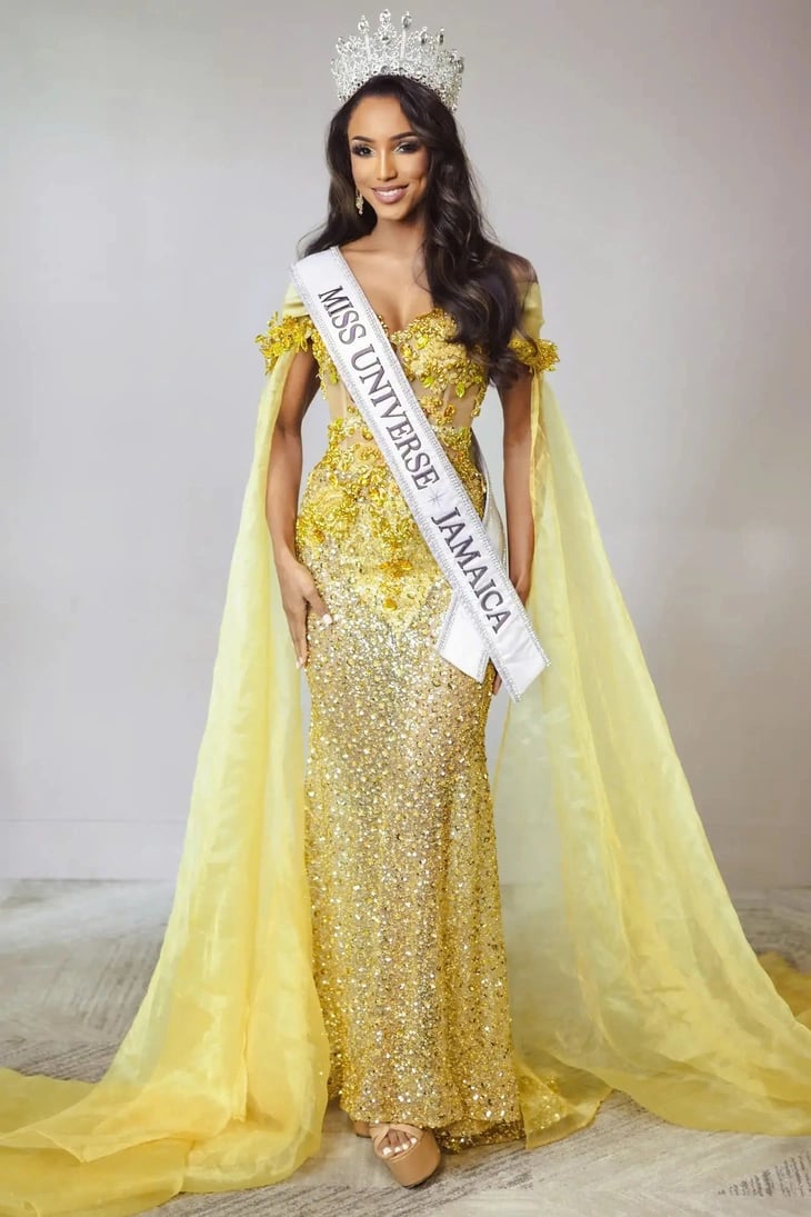 09-1765263326-hoa-hau-jamaica-chan-thuong-nghiem-trong-tai-miss-universe-2025-xuat-huyet-noi-so-gay-xuong-sau-cu-nga.webp