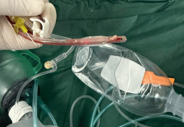 Truong-mam-non-bo-lo-gio-vang-khien-be-3-tuoi-tu-vong-do-sac-thuc-an-qua-2-tram-y-te-truoc-khi-goi-115