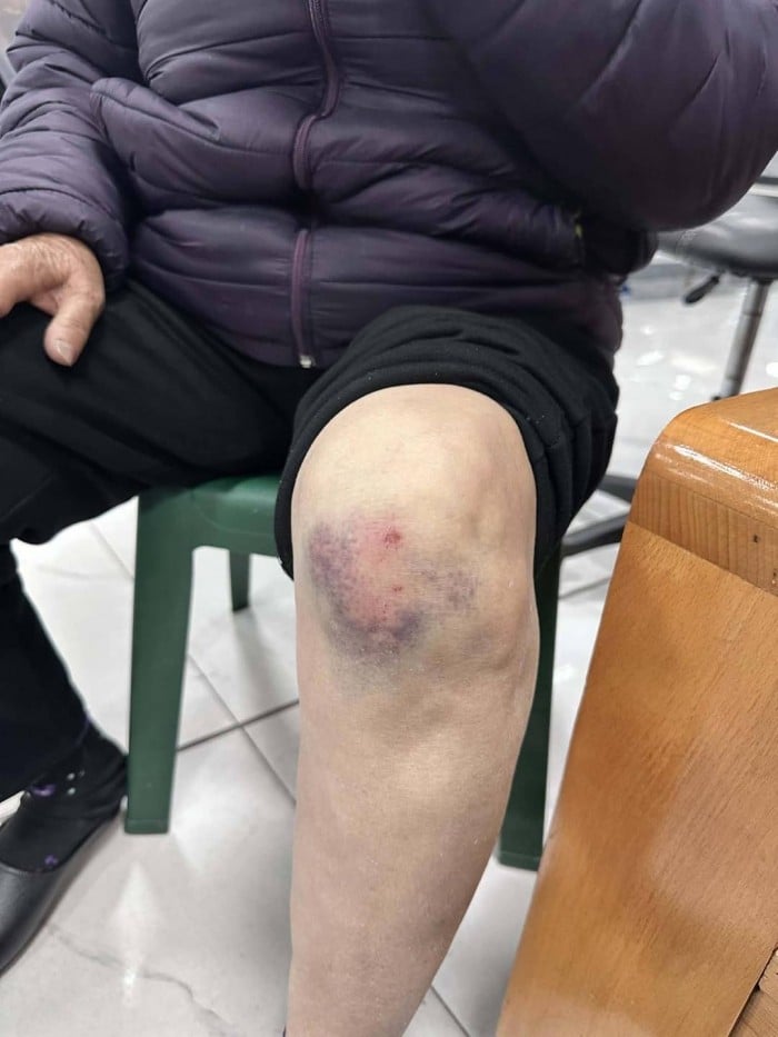 cu-ba-gan-80-tuoi-bi-phu-xe-limousine-ben-xe-bai-chay-hanh-hungh-be-dien-thoai-vi-tu-choi-len-xe-3