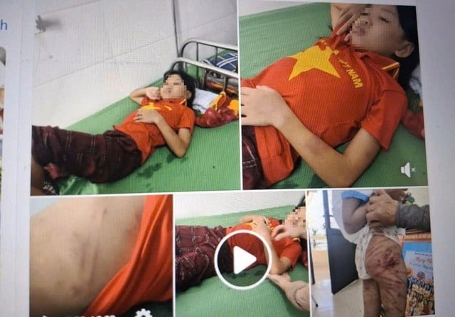 toa-tuyen-an-vu-nguoi-cha-duong-bao-hanh-be-gai-lop-5-o-ha-tinh-voi-vet-thuong-nhieu-khong-the-dem-3