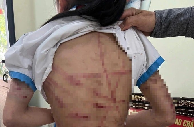 toa-tuyen-an-vu-nguoi-cha-duong-bao-hanh-be-gai-lop-5-o-ha-tinh-voi-vet-thuong-nhieu-khong-the-dem-6