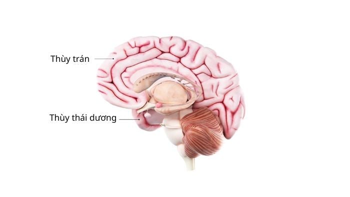 Sa sút trí tuệ thùy trán - thái dương tấn công các vùng não nằm phía sau trán và phía trên tai