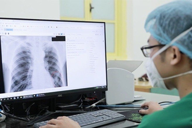 03-1770103960-bac-si-tran-tro-truoc-quy-dinh-chup-x-quang-du-6-phut-moi-duoc-thanh-toan-bhyt.jpg