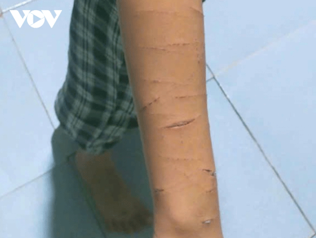 Chu-tich-ubnd-tinh-ca-mau-len-tieng-vu-be-gai-lop-5-bi-chi-ho-dung-dao-cat-giay-rach-nhieu-nhat-3