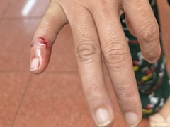 Ảnh bìa bài viết 1001452