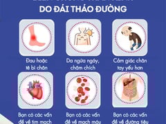 Ảnh bìa bài viết 1001614