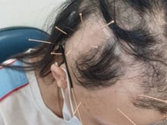 Ảnh bìa bài viết 1001740