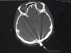 Ảnh bìa bài viết 1004037