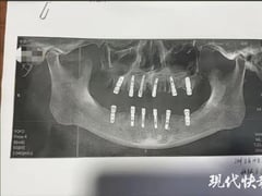 Đọc nhanh bài viết 1004997