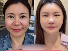Đọc nhanh bài viết 1007448