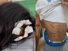 Đọc nhanh bài viết 1016674