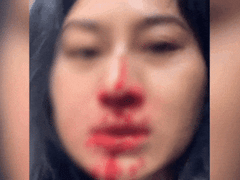 Đọc nhanh bài viết 1018224