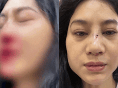 Đọc nhanh bài viết 1018280