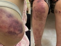 Đọc nhanh bài viết 1021046