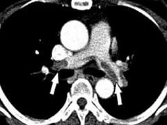 Đọc nhanh bài viết 1022141