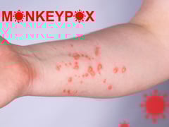 Đọc nhanh bài viết 1022585