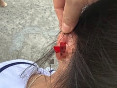 Đọc nhanh bài viết 1023979