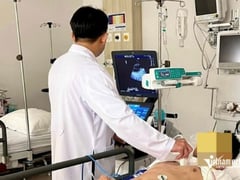 Đọc nhanh bài viết 1024421