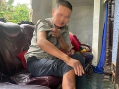 Đọc nhanh bài viết 1026406