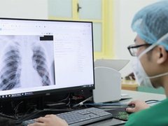 Đọc nhanh bài viết 1028550