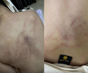 Đọc nhanh bài viết #1001263