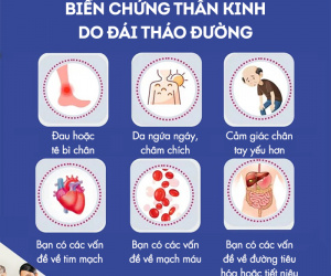 Đọc nhanh bài viết #1001614